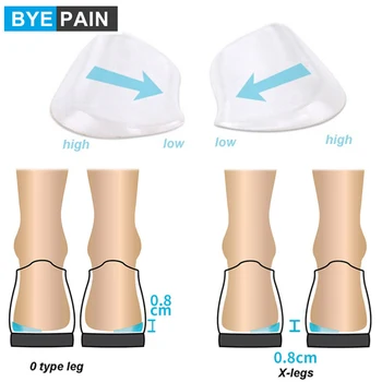 1 Çift Jel Ortopedik Tabanlık Ayakkabı Ekler Medial ve Lateral Topuk Kama Kaldırma Silikon Pedleri Düzeltici O / X Tipi Bacak Kadınlar Erkekler için